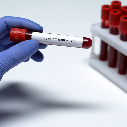 Cancer Screening Package