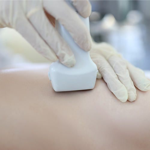 Cancer Screening Package Singapore